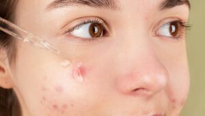 Retinol para la piel: qué es, cómo funciona y cómo usarlo sin irritación