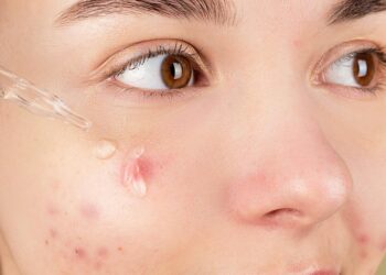 Mujer aplicando sérum de retinol en la piel del rostro como parte de su rutina de cuidado de la piel