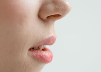 Primer plano del rostro de una mujer donde se aprecian los poros abiertos de la nariz y las mejillas